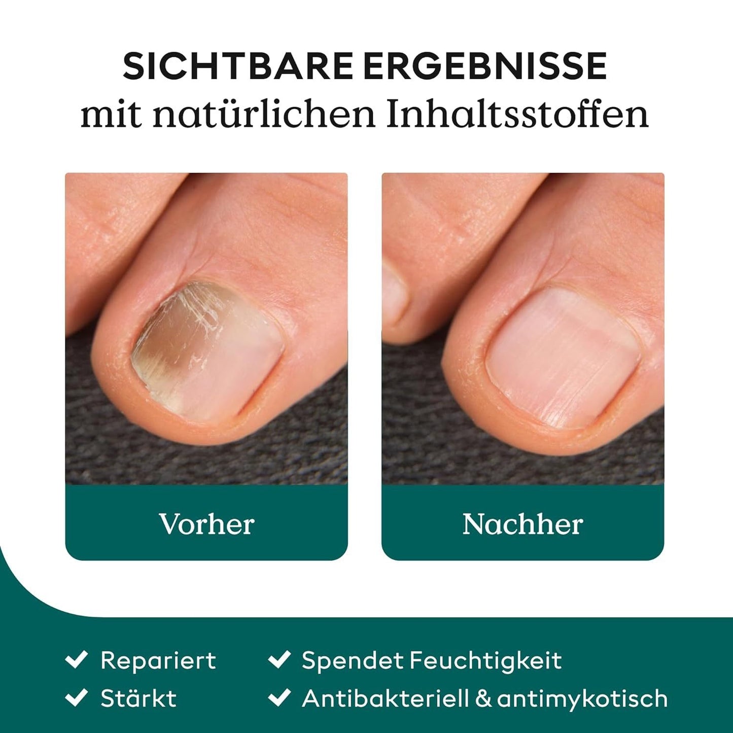 Nail Care Pen