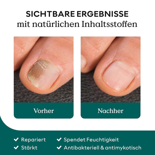 Nail Care Pen